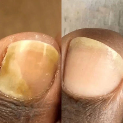 Avenlo’s fungus destroyer